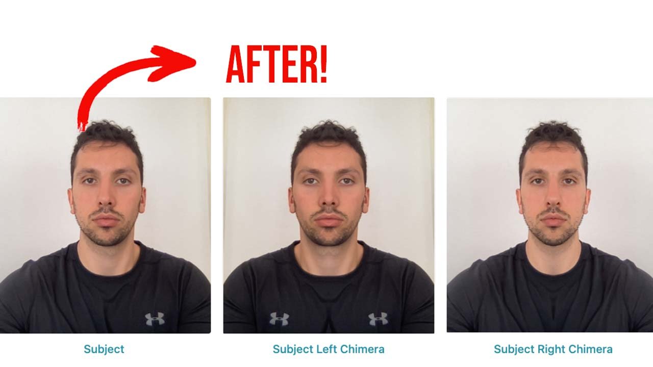 How to Mew Evenly: Fixing Asymmetry Caused by Imbalanced Tongue ...